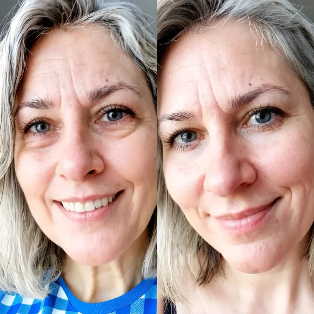 Look More Rested in Minutes with AuraLift™ — 2-in-1 Red Light + EMS Eye System