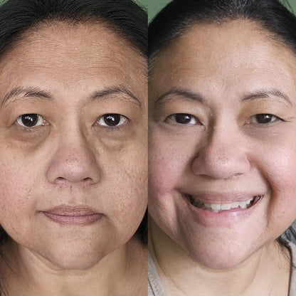 Look More Rested in Minutes with AuraLift™ — 2-in-1 Red Light + EMS Eye System
